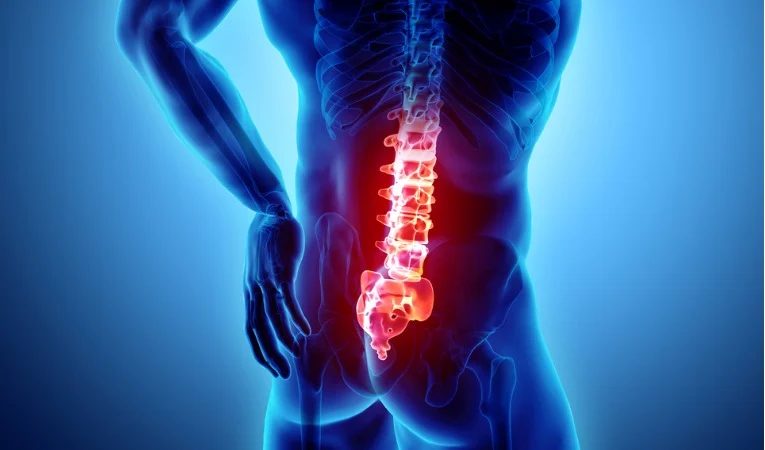Wie man Rückenschmerzen behandelt padel ?